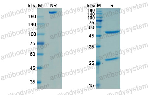 Валидация SDS-PAGE - AntibodySystem DXX05301