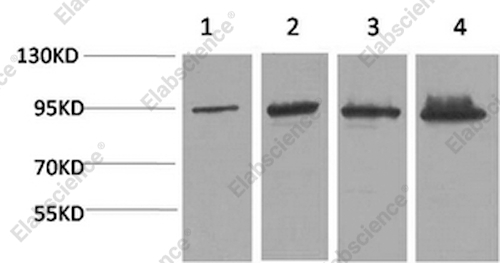Вестерн-блоттинг, Catenin beta, клетки HeLa, 293T и ткань печени мыши и крысы