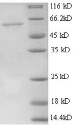 SDS-PAGE