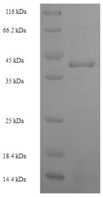 SDS-PAGE