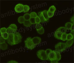 Валидация IF - AntibodySystem RHB86922