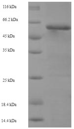 SDS-PAGE