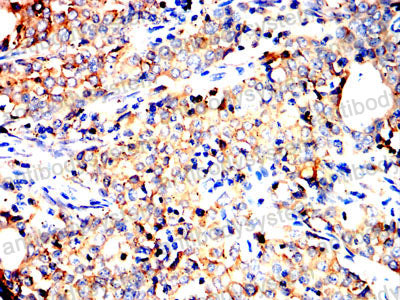 Валидация AntibodySystem RHC24106