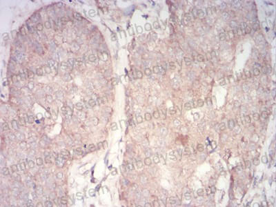 Валидация AntibodySystem RHA56303