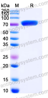 EHJ99701, SDS-PAGE