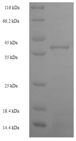 SDS-PAGE