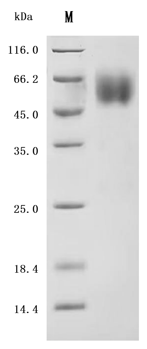 SDS-PAGE