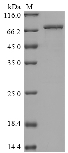 SDS-PAGE
