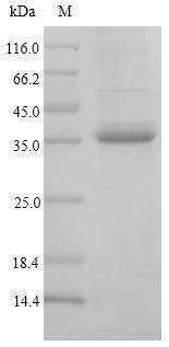 SDS-PAGE