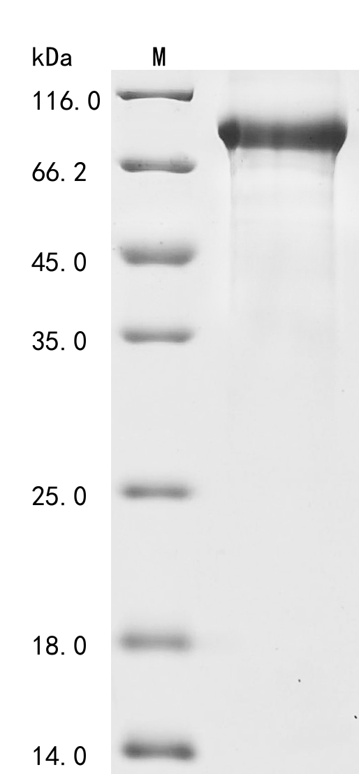 SDS-PAGE