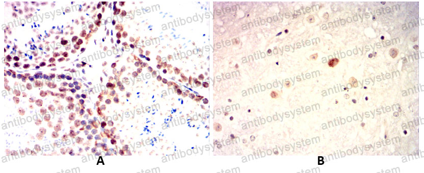 Валидация AntibodySystem RHG96902 (3131)