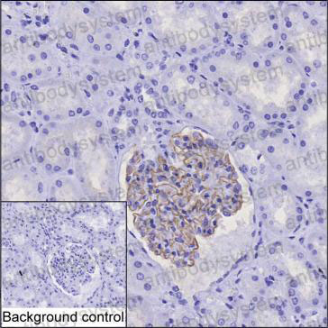 Валидация AntibodySystem RHJ62302