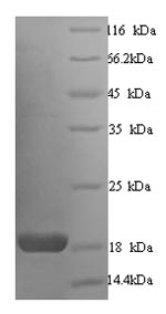 SDS-PAGE