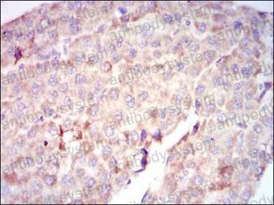 Валидация AntibodySystem RHC05403