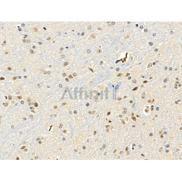 Валидация Affinity AF5361 - 2972