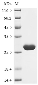 SDS-PAGE