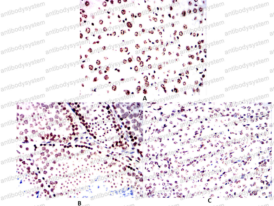 Валидация AntibodySystem RHE37705 (2129)