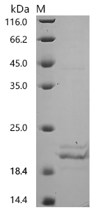 SDS-PAGE