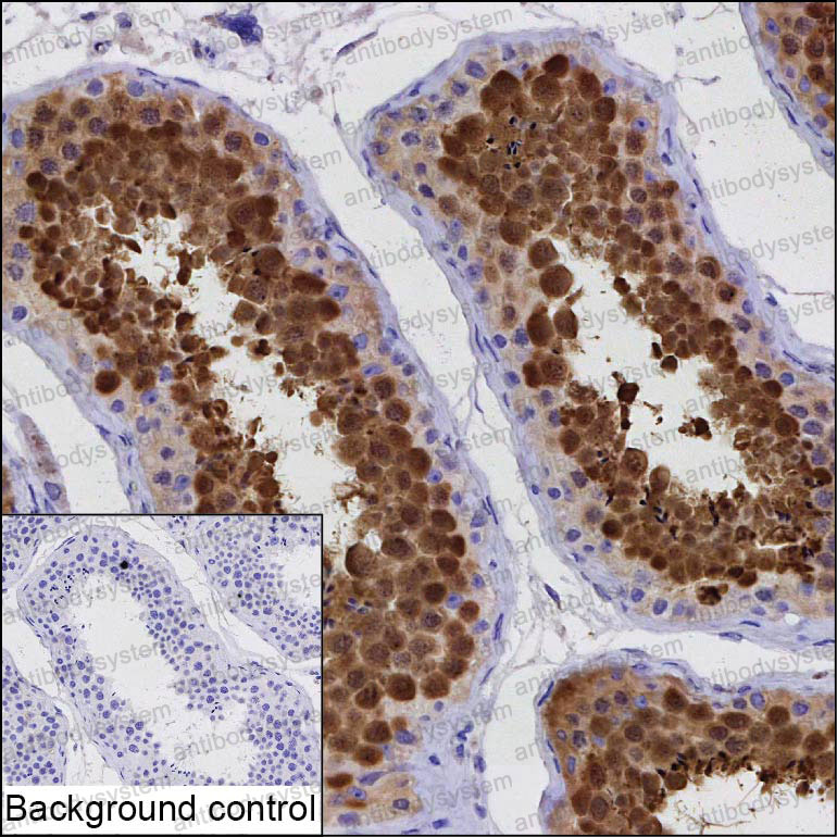 Валидация AntibodySystem RHF04103