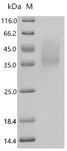 SDS-PAGE