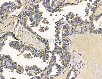 Валидация Affinity DF15984 - 12515