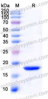 AHD47701, SDS-PAGE