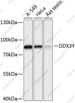 Вестерн-блоттинг, DDX3Y, различные клеточные линии