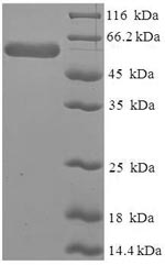 SDS-PAGE