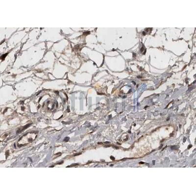 Валидация Affinity AF5264 - 2778