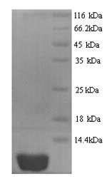 SDS-PAGE