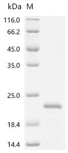 SDS-PAGE