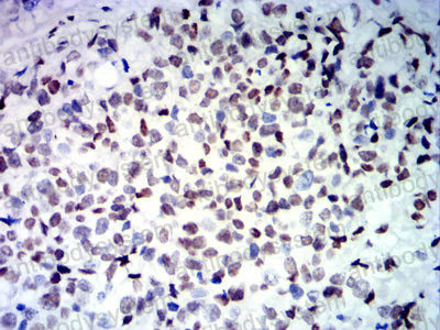 Валидация AntibodySystem RHJ45304 (3426)