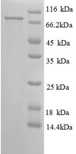SDS-PAGE