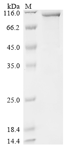 SDS-PAGE