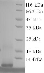 SDS-PAGE