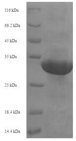 SDS-PAGE