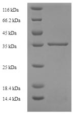 SDS-PAGE
