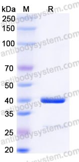 YHE84901, SDS-PAGE