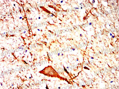 Валидация AntibodySystem RHJ02207 (3322)