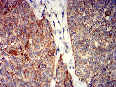 Валидация AntibodySystem RHH24201