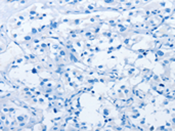 Валидация AssayVector ARM1667(1851)