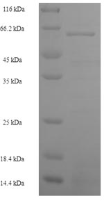 SDS-PAGE
