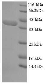SDS-PAGE