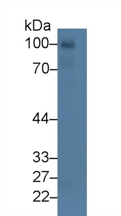 14014