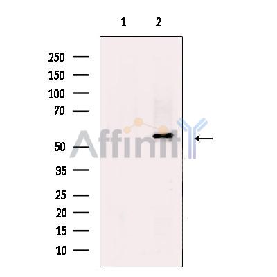 Валидация Affinity DF13570 - 9030