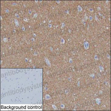 Валидация AntibodySystem RHP00901