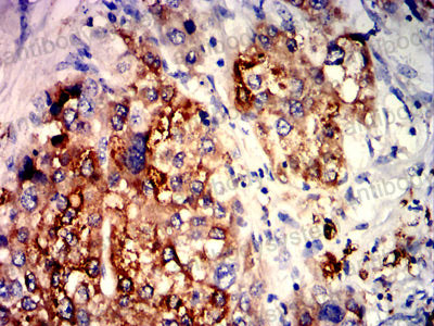 Валидация AntibodySystem RHN97802