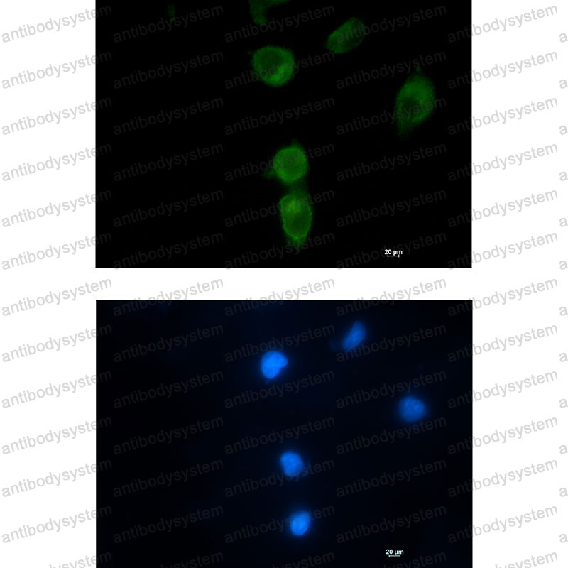 Валидация IF - AntibodySystem RHB39401