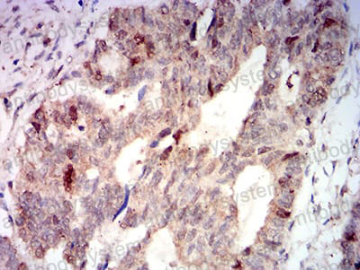 Валидация AntibodySystem RHA36105