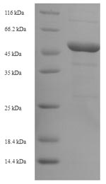 SDS-PAGE